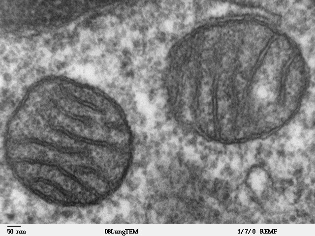 Transmission electron micrograph of two mitochondria in mammalian lung tissue. Dartmouth Electron Microscope Facility. Public domain, via Wikimedia Commons.